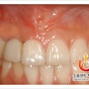 수플란트 이미지