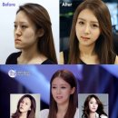 렛미인 - 연수구 | 렛미인