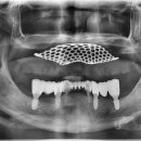 오케이치과기공소 이미지