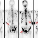 프로스타짐 이미지