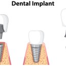 365석치과의원 이미지