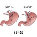 셀러스트 | 四字成語 총정리 &lt;ㄱ&gt; 744 관형찰색~괄약근성형