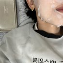 둔산DS피부과의원 | 강남역피부과 추천! 강남역 밴스의원에서 받은 피코토닝 후기
