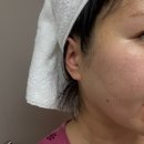 알엠뷰티 | 메시엘PDRN 수분 마스크팩 촉촉하고 붉은기에 좋아요