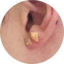 후니쇼핑몰 | 이혈침 추천 셀비오 이어밸런스 귀지압패치 후기!!!