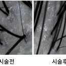 러블린헤어
