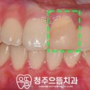 청주으뜸치과의원 이미지