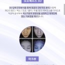 피부가 밝아지는 미백레이저 IPL 시술 후기