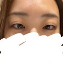 산동약국 | 수원 문안과 라섹 후기 1편 검안부터 수술 당일, 솔직한 통증 후기