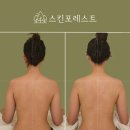 보령 | W)보령 웨딩관리 | 보령 스킨포레스트 솔직후기