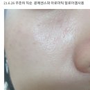 디원씽 | [쿠팡구매후기] 쿠팡 화장품 구매시 가품 주의_디오디너리 나이아신10%+ 징크1%(feat.내돈내산)