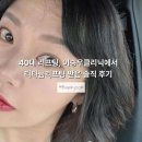 이승우 | 40대 리프팅, 이승우클리닉에서 티타늄리프팅 받은 솔직 후기