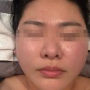 코압빌딩 | 클로이에스테틱 강남선릉점 여드름관리 후기 | 30대 수부지 여드름 피부 체험기