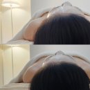 오른 | 경산윤곽관리 추천 윤곽밸런스 물오른피부 후기