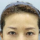 모자이크성형외과의원 이미지