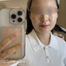 바인 | 스킨부스터 듀얼젠 피부한의원 바인허브클리닉 솔직후기