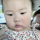 대구 성서한마음연합소아청소년과의원 : 달서구소아과, 성서소아과, 유아두드러기, 유아알레르기, 휴일...