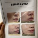 천보 퍼스널 스튜디오 | 하체비만관리는 동탄역피부과에서-동탄다이어트 종아리보톡스로 종아리알빼고온 후기🦵🏼