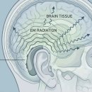 스마트보청기 청각언어센터 이미지