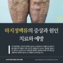 하지정맥류의 치료와 예방 | 울퉁불퉁 혈관의 경고! 하지정맥류의 증상과 원인 치료와 예방