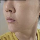 하늘땅어린이집 | 강남역 피부과 텐쎄라 가격 통증 부작용 내돈내산 후기