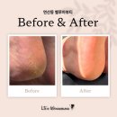 연제구-147 | 연산동패디플래닝 벨루아뷰티 | 10년 묵은 각질 순삭! 아기 발 된 리얼 후기 (강추!)