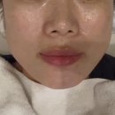 루미너스 에스테틱 | 화정에스테틱 루미너스에스테틱 본점 티리온X 리프팅 후기 이중턱 사각턱 볼처짐 탄력폭발