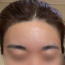 퀸즈헤어라인 | 좁은이마 고민 왁싱으로 해결! 발산 헤어라인 왁싱 비엔왁싱 방문 후기