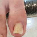 페디앤럭스네일 | 도곡 매봉 내성발톱,무좀발톱,발각질 꼼꼼한 케어 페디앤럭스네일 후기