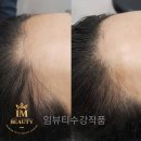 임뷰티 이미지