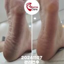 리턴스케어