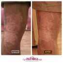 효소테라피 이미지