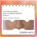 더에스테오