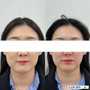 태화중앙로(남) | W00. 웨딩관리 손수에스테틱 관리받고 왔어요!