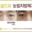 골드지의원