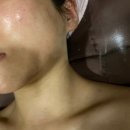 유턴에스테틱 | 반포 윤곽관리 핫탄스파 반포점 후기 | 예비신부 피부관리, V라인 윤곽 관리 솔직 리뷰