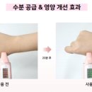 센티스킨
