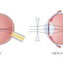 아이세이버 미남역점 이미지
