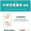 열린한의원대구 이미지