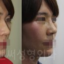 앤써성형외과의원 이미지