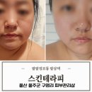 얼짱스킨 | 울산 구영리 피부관리 스킨테라피 온da 전문가의 집중 관리 후기