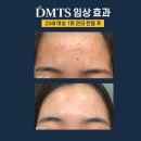 피부맑음