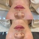 포미뷰티