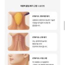 신상성형외과의원 | 신상성형외과 이중턱 지흡 내돈내산 후기 1탄 (상담, 수술 1일차)