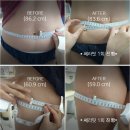 테라메디랩 | 산후 바디관리기 (원쎄라리프팅+쎄라핏 비만관리기) 후기