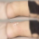 이래서 에스테틱 | [착맘씨]청주 이래서 에스테틱 : 복부관리 후기
