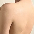 (주)중부메디칼 | 대구 동성로 피부과 승모근 보톡스 추천 ! 내돈내산 전후사진 후기