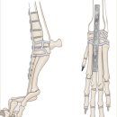 수원-0323 | [공지] 포메라니안 만성관절염 | 관절고정술 - 비수술적 재활방식