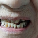 모아치과기공소 이미지