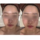 내가꾸다 | 창원 웨딩관리 피부를 가꾸다